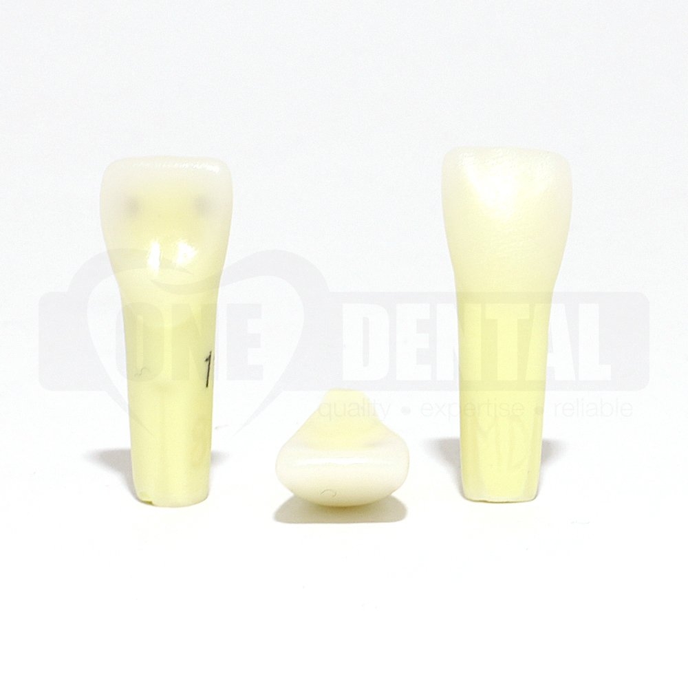 Caries Tooth 11 MD for 2010 Adult Model MT