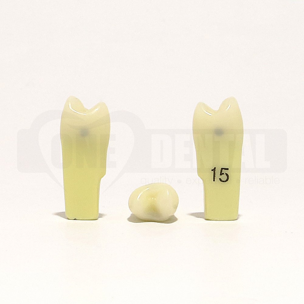 Caries Tooth 15 M & D for 2010 Adult Model