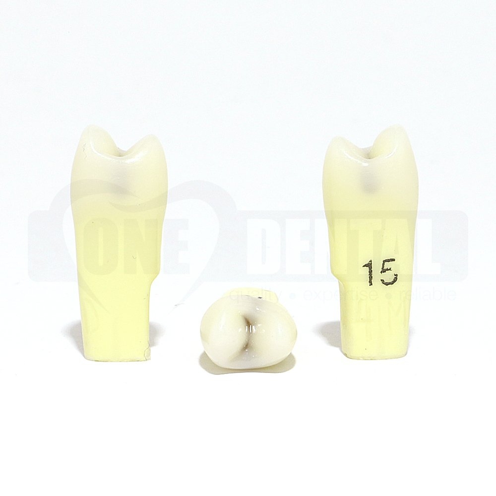 Caries Tooth 15 MOD for 2010 Adult Model MT