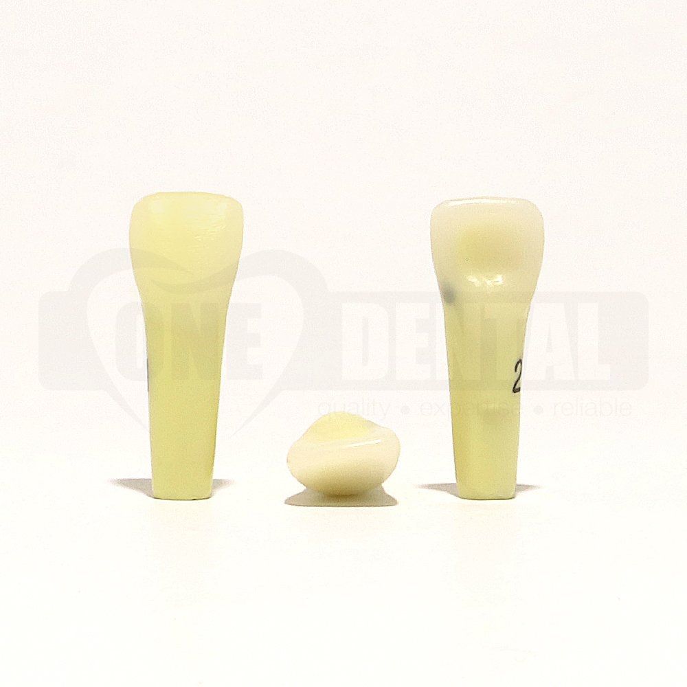 Caries Tooth 21 Mesial for 2010 Adult Model