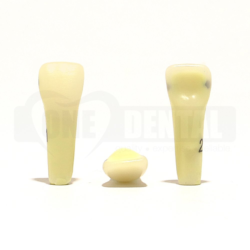 Caries tooth 21MD for 2010 Adult Model