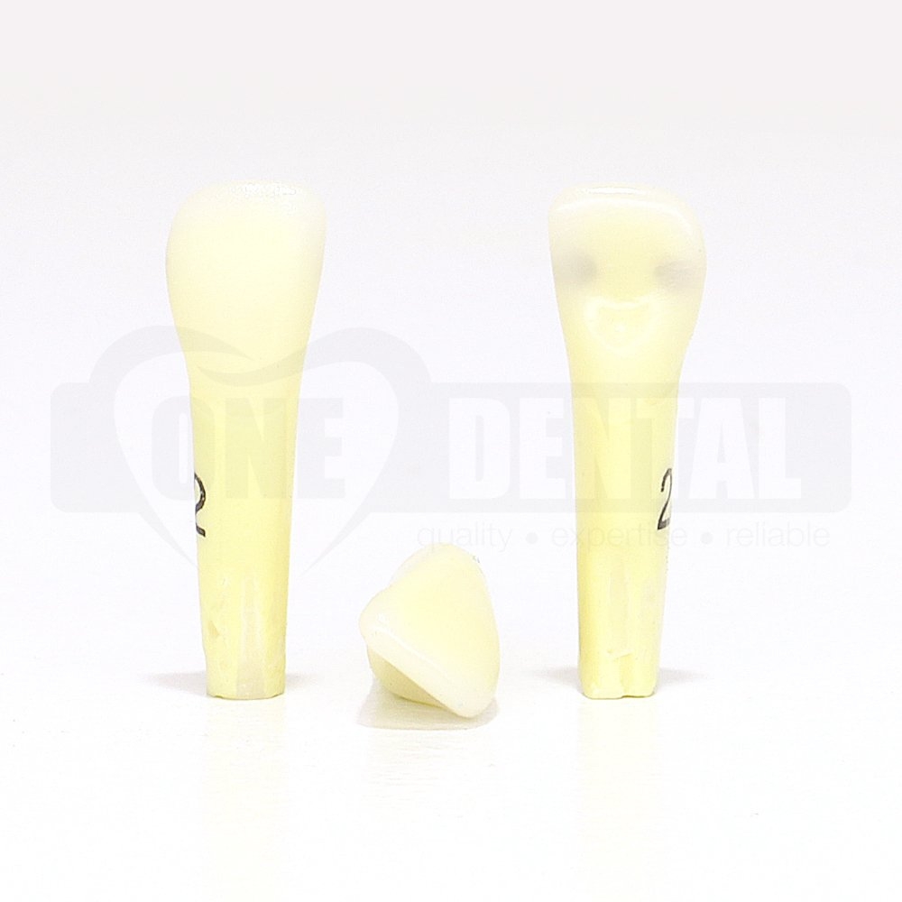 Caries tooth 22MD for 2010 Adult Model (JM)