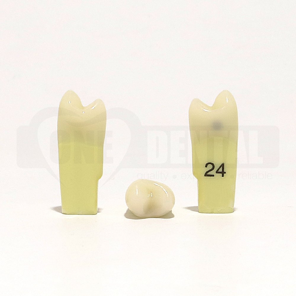 Caries Tooth 24D for 2010 Adult Model