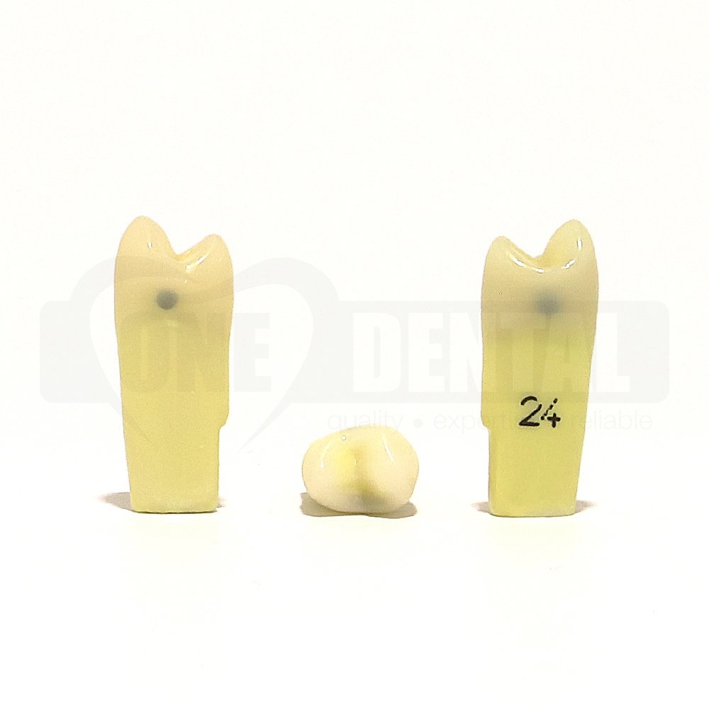 Caries Tooth 24MD for 2010 Adult Model