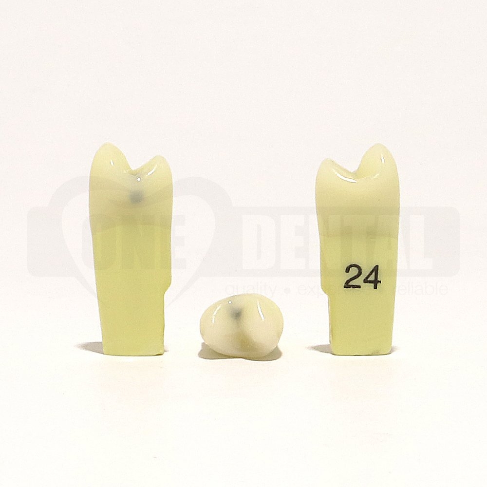Caries Tooth 24MO for 2010 Adult Model