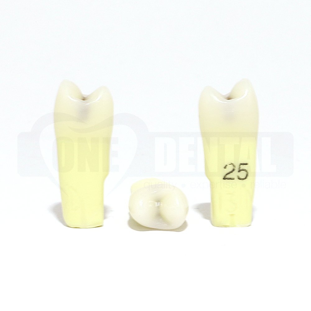 Caries Tooth 25 MOD for 2010 Adult Model MT