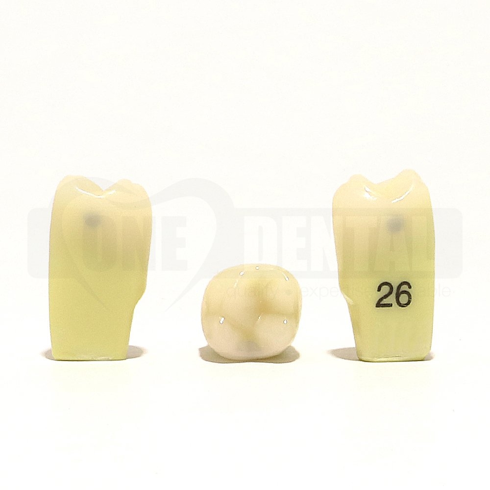 Caries tooth 26MD for 2010 Adult Model