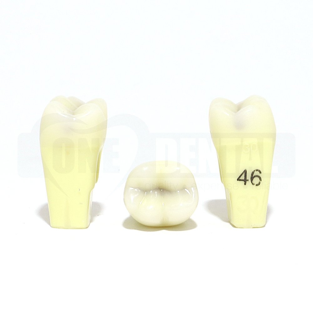 Caries Tooth 46 MOD for 2010 Adult Model