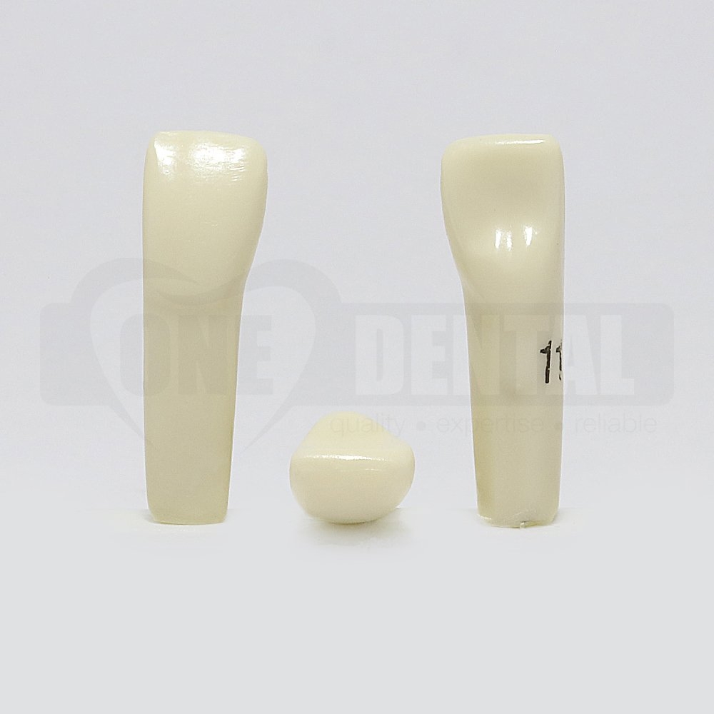 Prep Tooth 11 Diastema RB for 2010 Adult Model