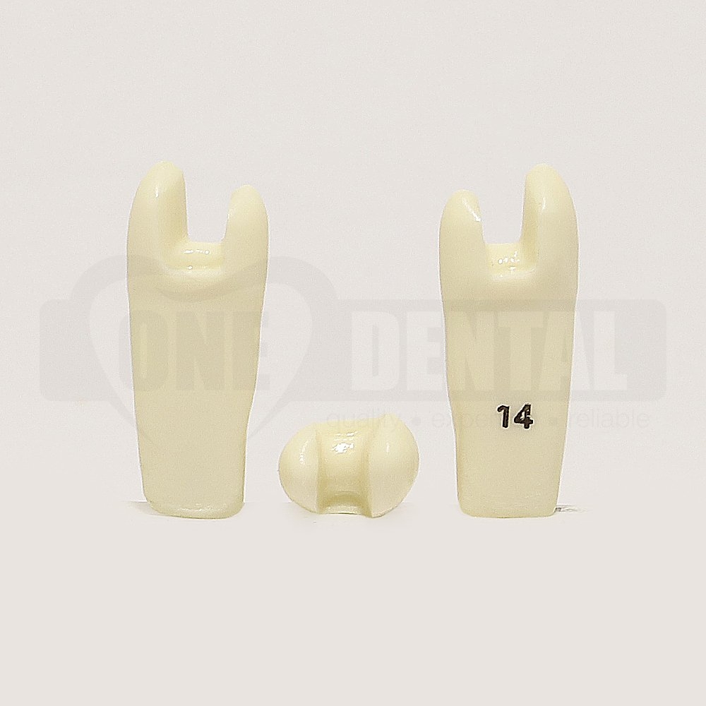 Prep Tooth 14MOD RE for 2010 Adult Model
