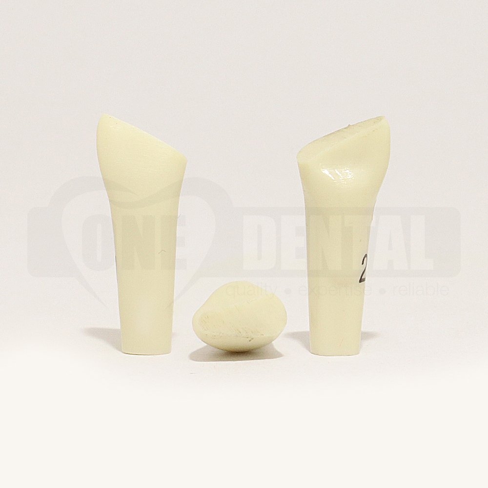 Prep Tooth 21 Mesial Fracture 2010 Adult Model