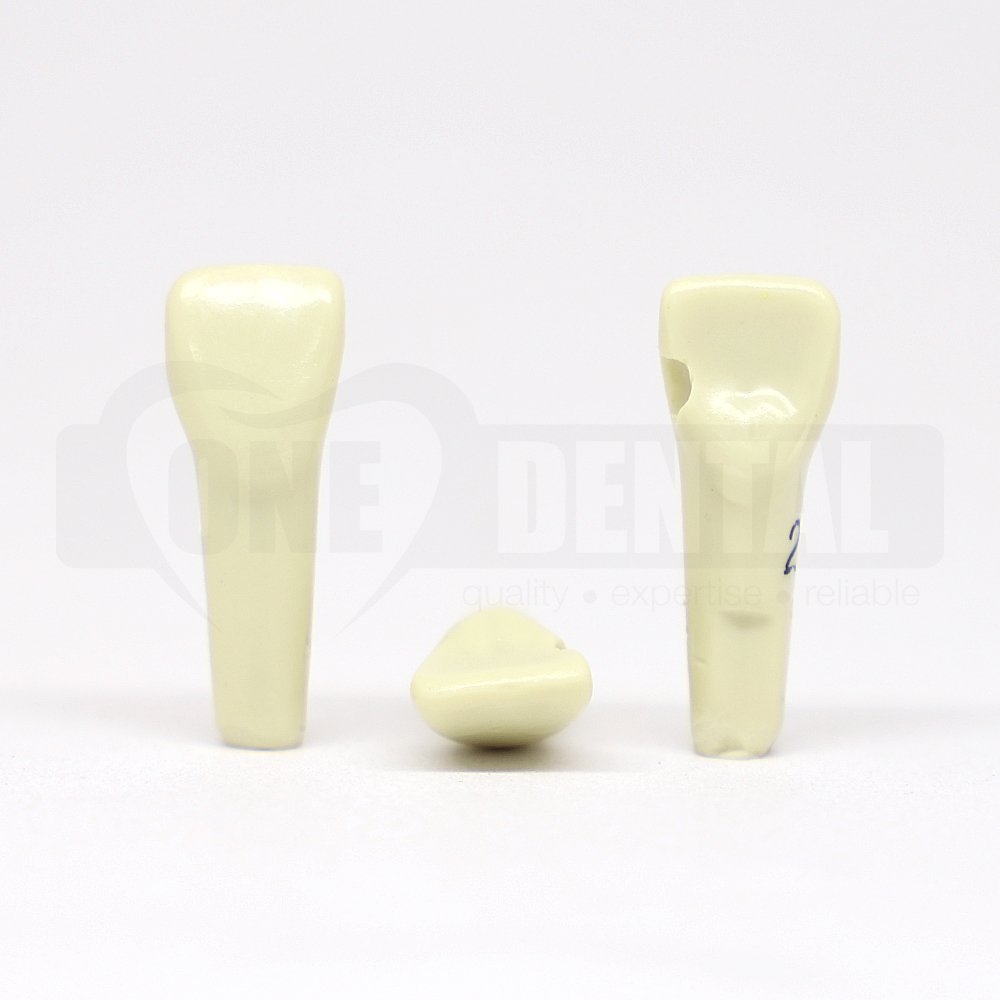 Prep Tooth 21 Mesial Palatal for 2010 Model