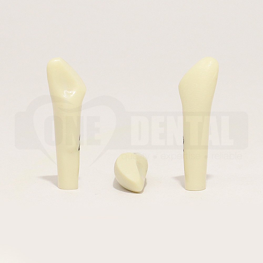 Prep Tooth 22 Distal Incisal Fracture PC for 2010 Adult Model