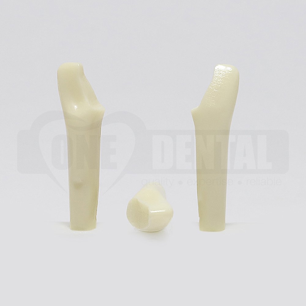 Prep Tooth 22 FRAC Distal - JK for 2010 Adult Model
