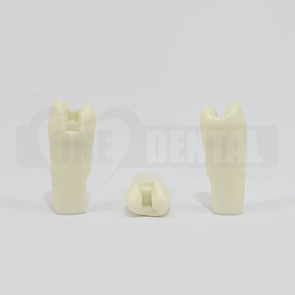 Prep Tooth 25 MO for 2010 Adult Model