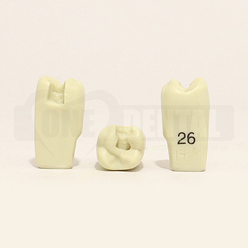 Prep Tooth 26MO for Adult 2010 Model