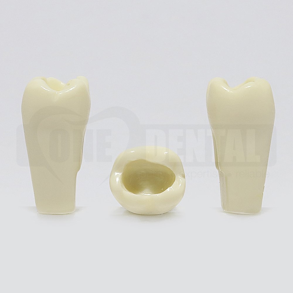 Prep Tooth 46 OCC ACP - JK for 2010 Adult Model