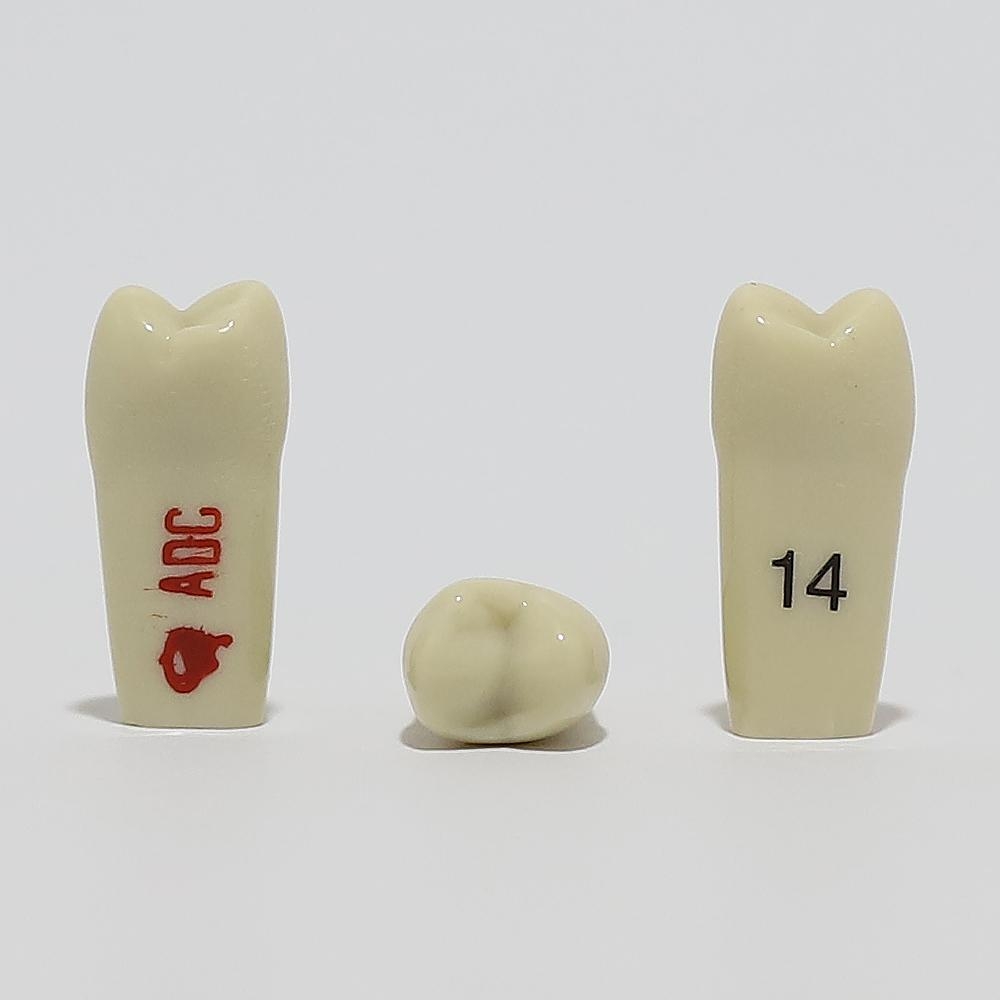 ADC Tooth 14 for ADC Model