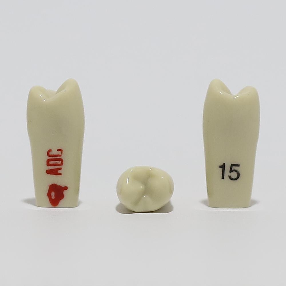 ADC Tooth 15 for ADC Model