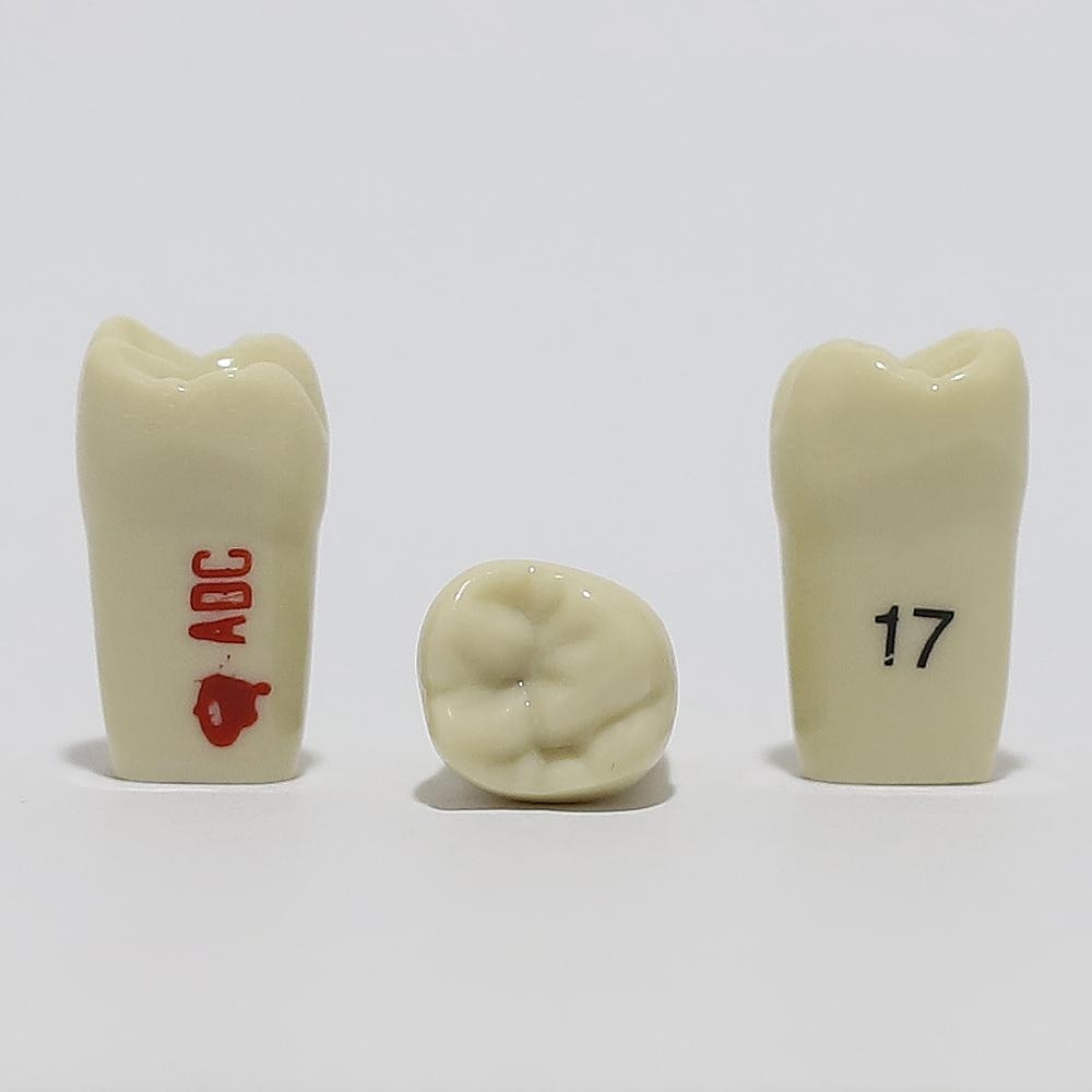 ADC Tooth 17 for ADC Model
