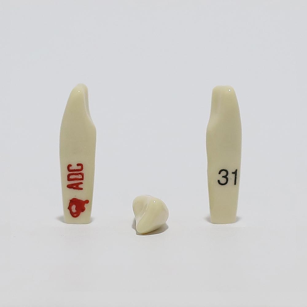 ADC Tooth 31 for ADC Model