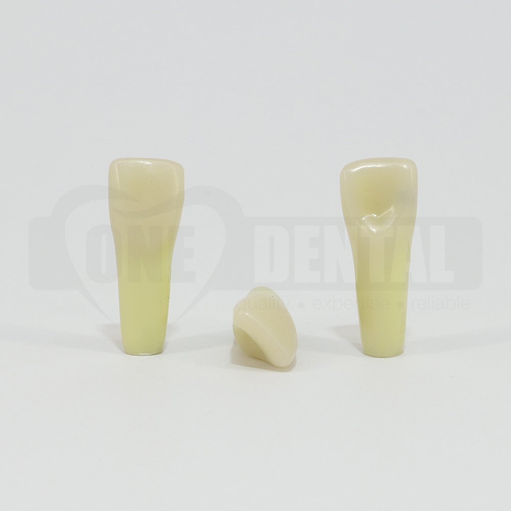 Caries Tooth 11 Mesial for ADC Model