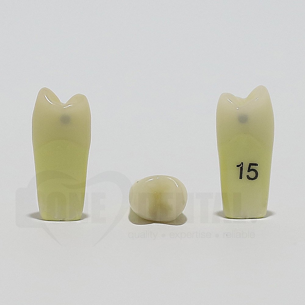 Caries Tooth 15 M+D for ADC Model