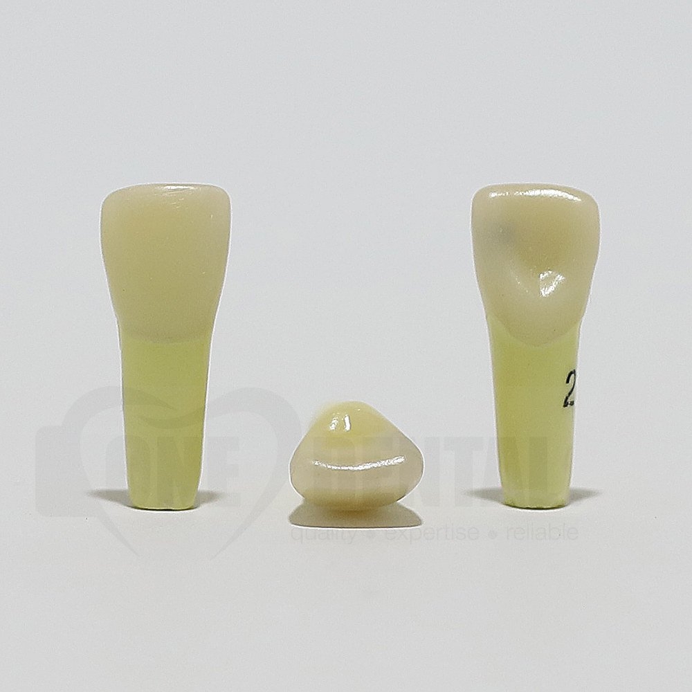 Caries Tooth 21M for ADC Model
