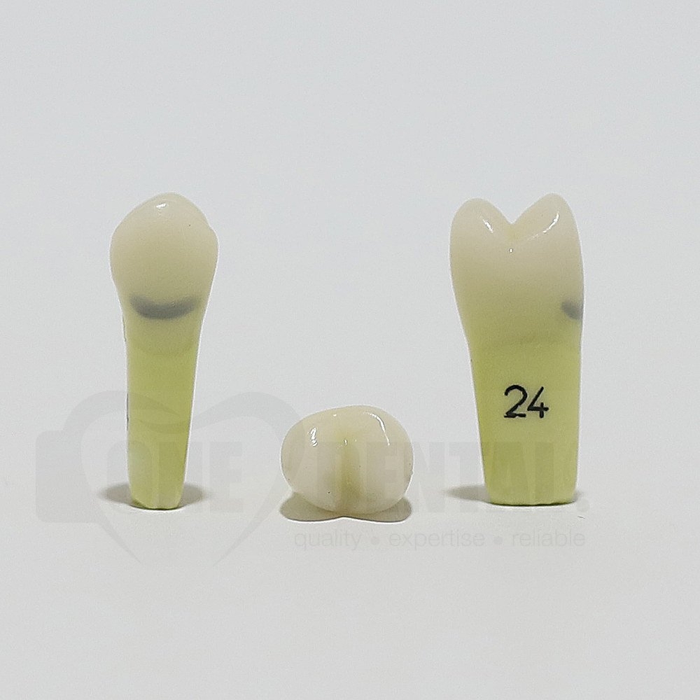Caries Tooth 24 Cervical for ADC Model