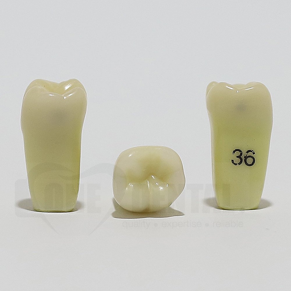 Caries Tooth 36 M+D for ADC Model