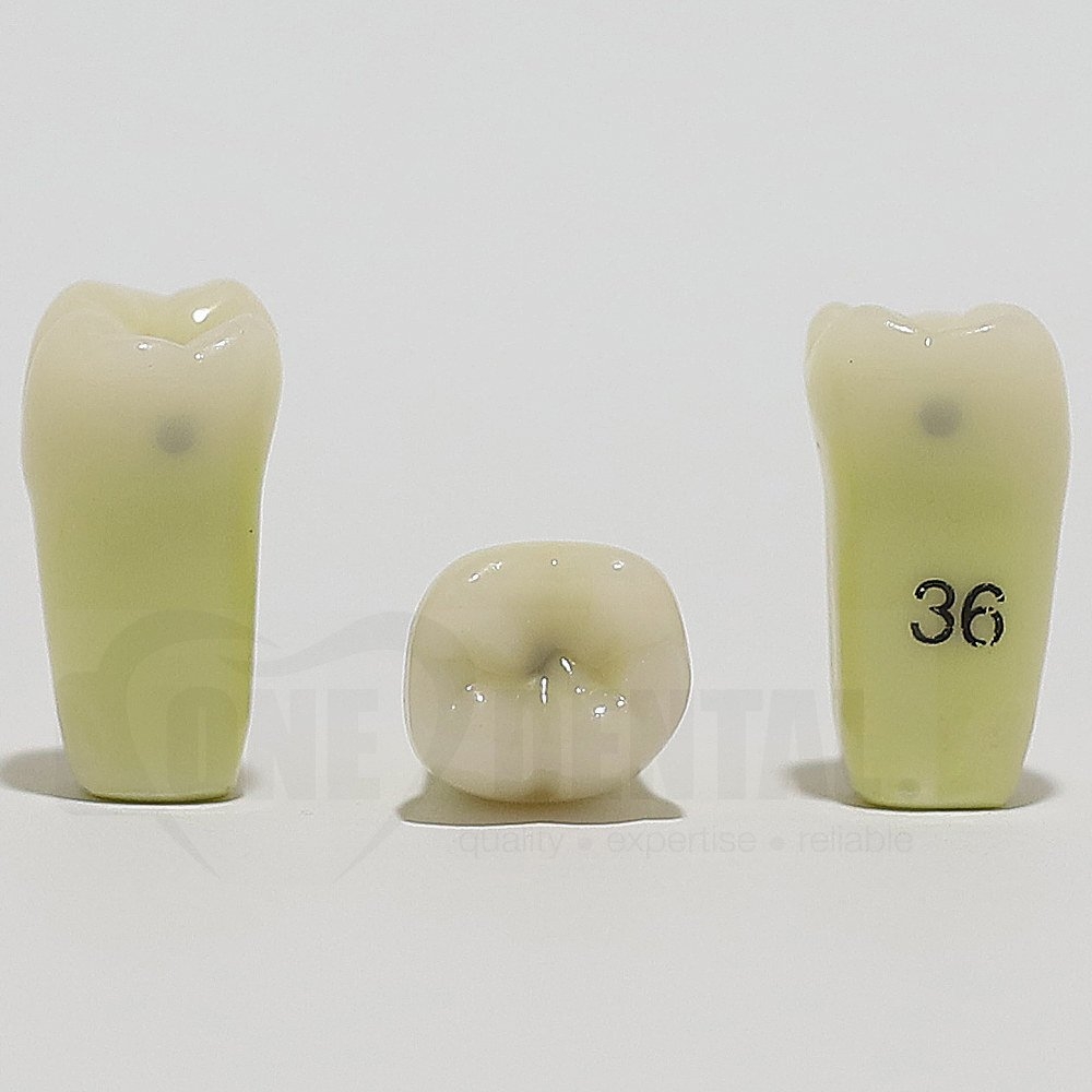 Caries Tooth 36 M+O+D Small for ADC Model