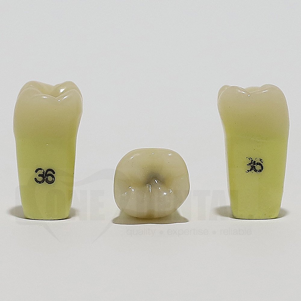 Caries Tooth 36 Occ for ADC Model