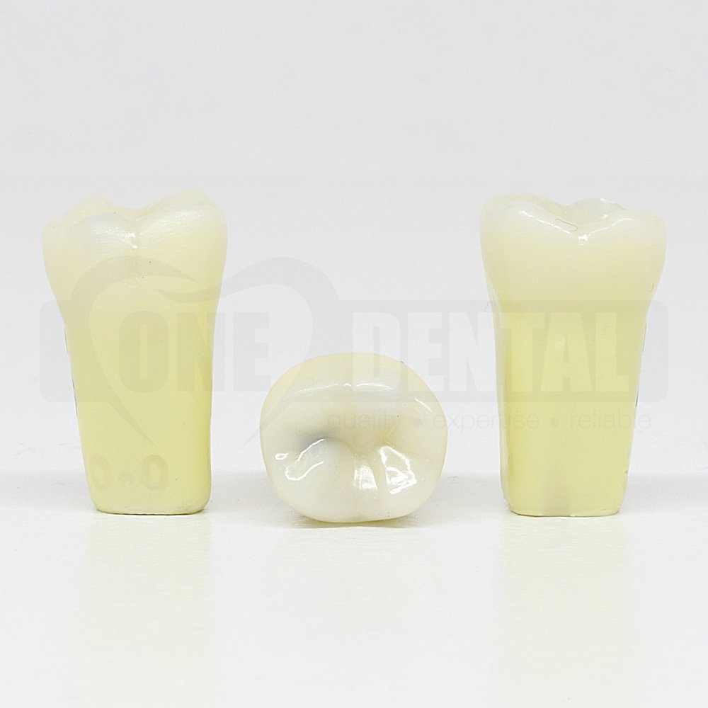 Caries Tooth 46 Occ for ADC Model