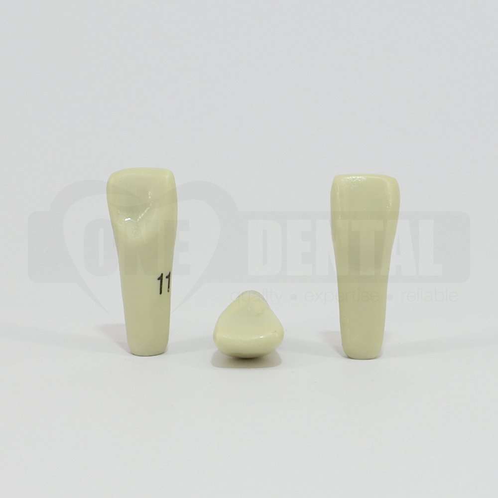 Prep Tooth 11 Diastema for ADC Model