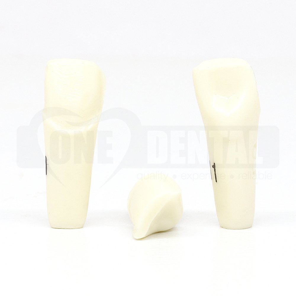 Prep Tooth 11 Veneer for ADC Model