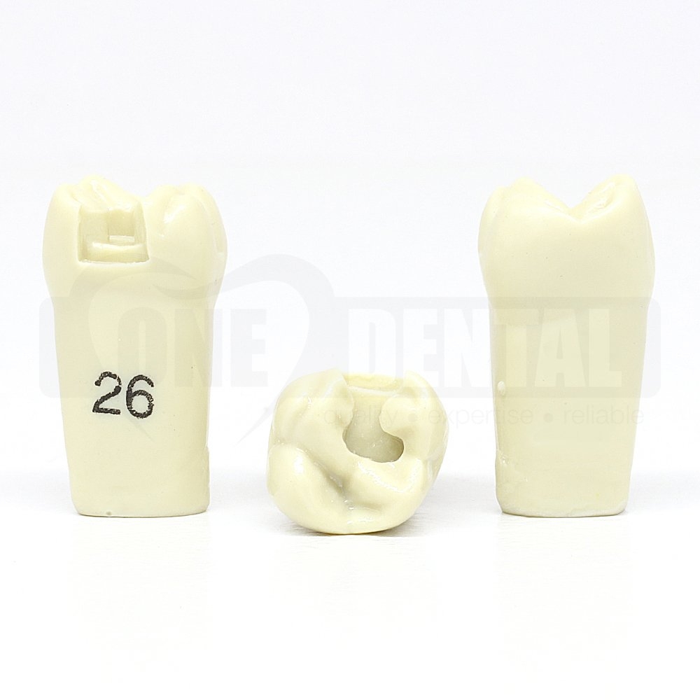 Prep Tooth 26 MO for ADC Model