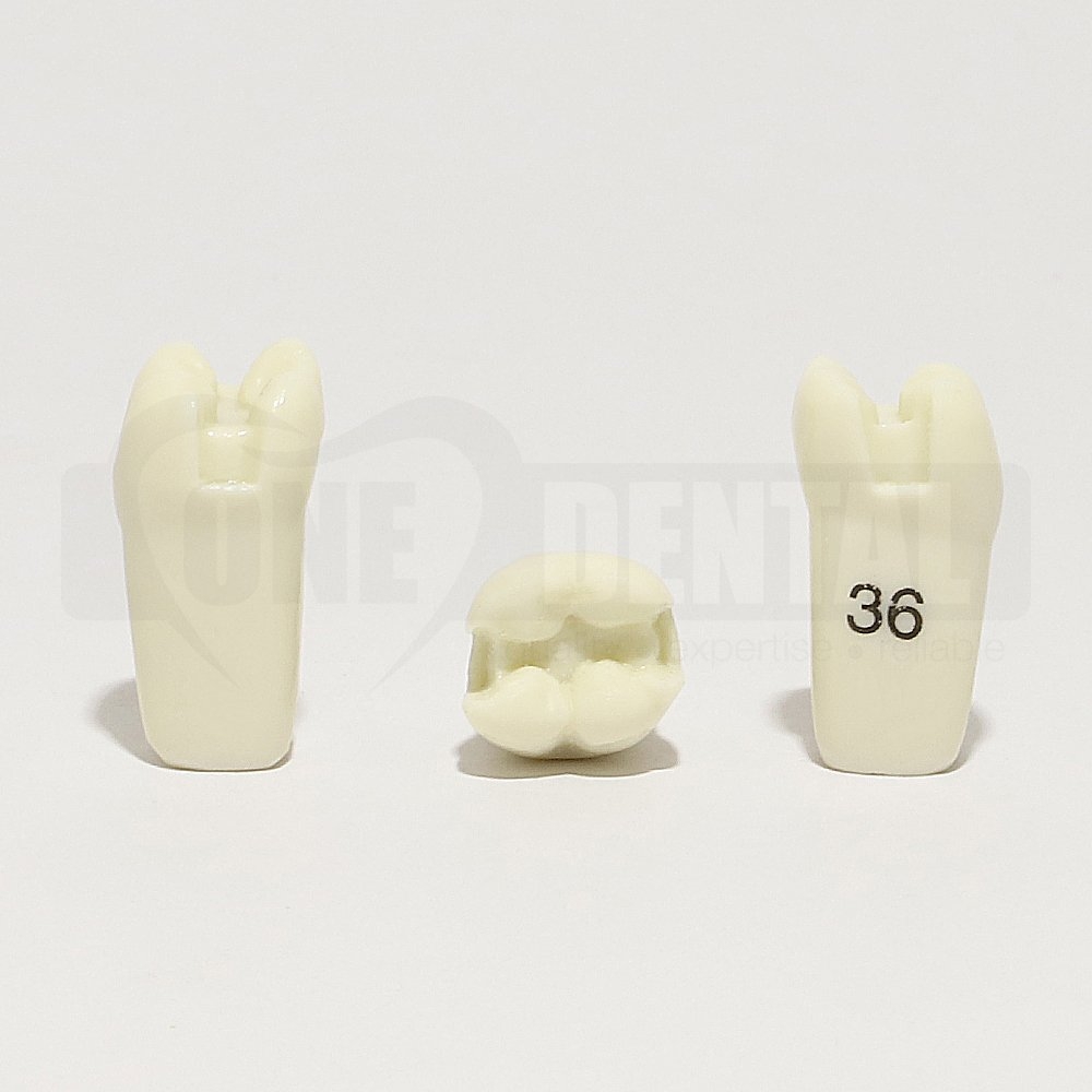Prep Tooth 36MOD for ADC Model