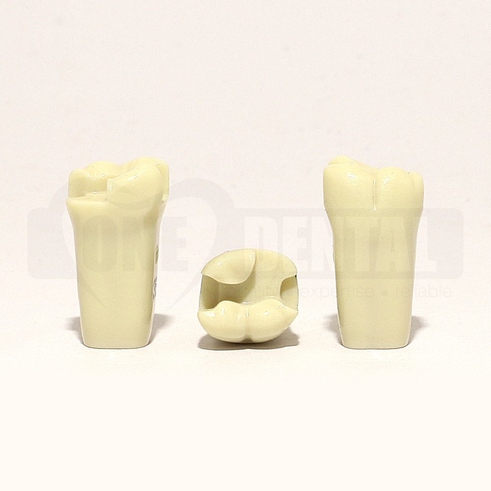 Prep Tooth 36MODL for ADC Model