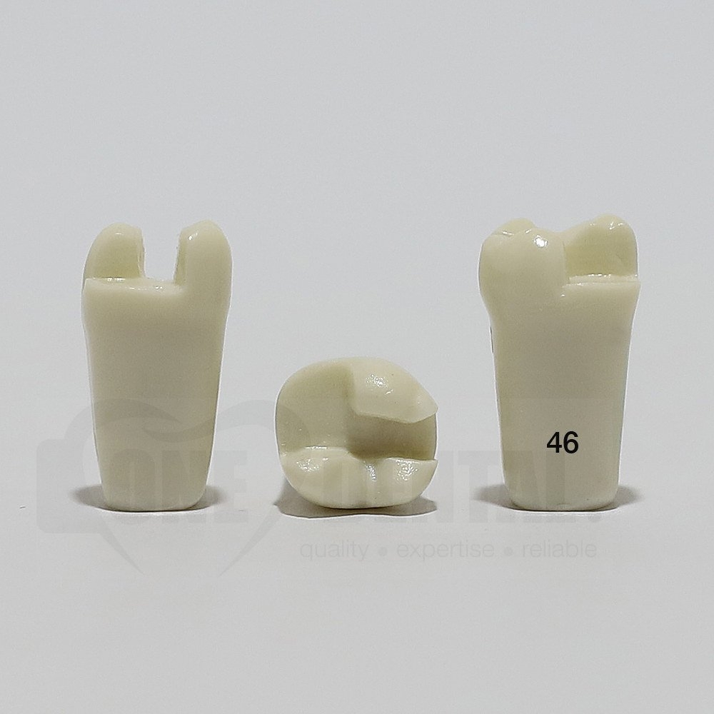 Prep Tooth 46MODB for ADC Model