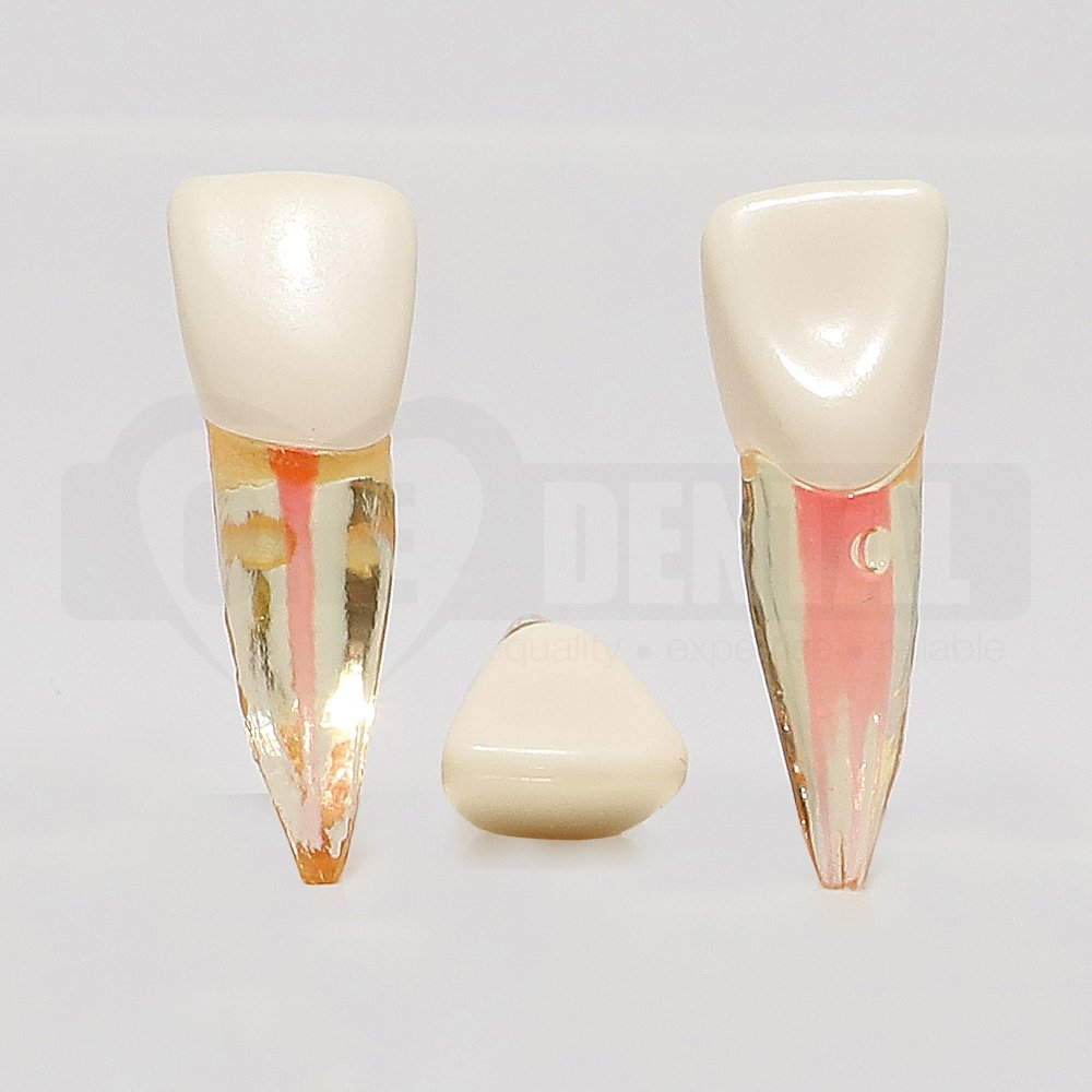 Natural Root Endo Tooth 11