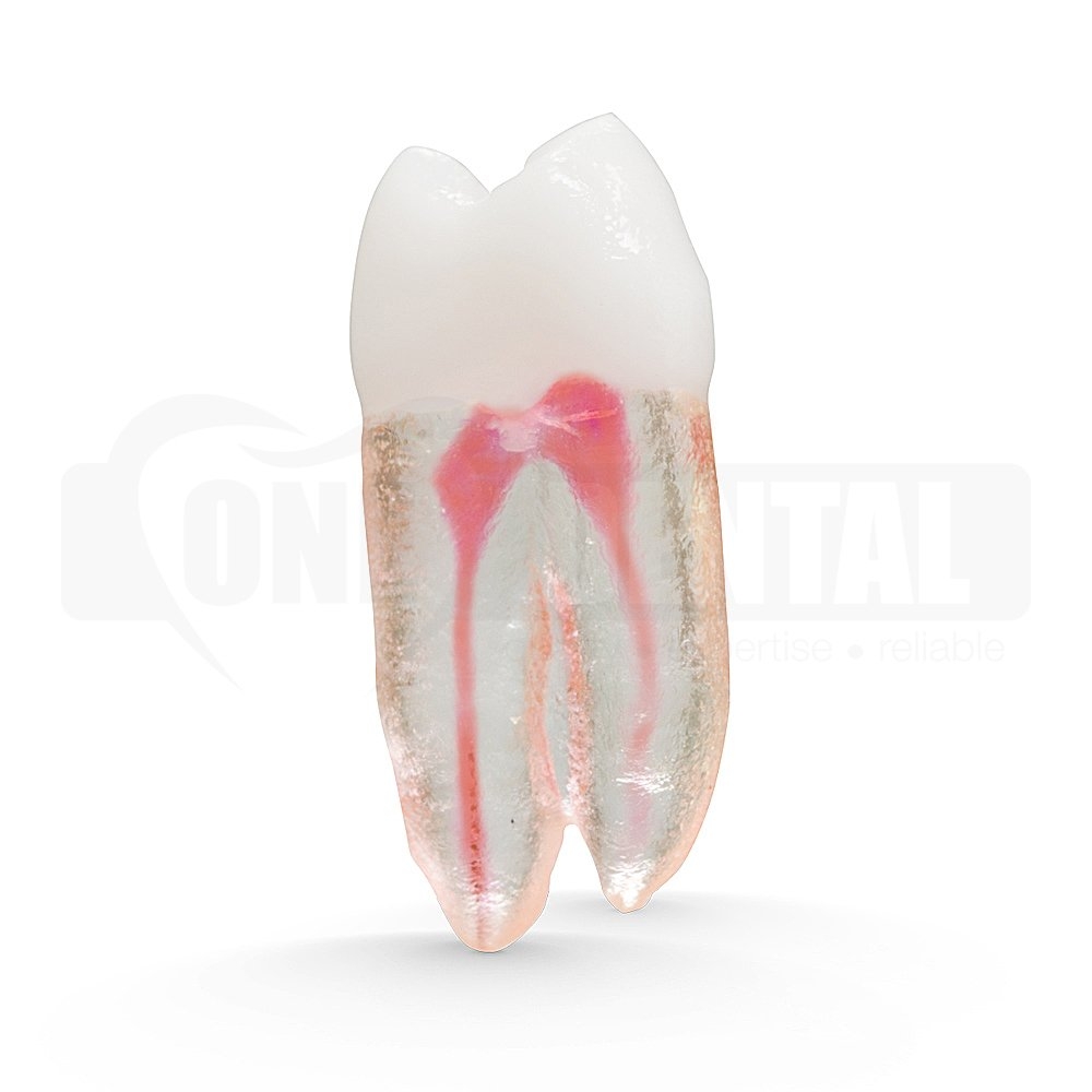 Natural Root X2 Endo Tooth 14 (Radiopaque)
