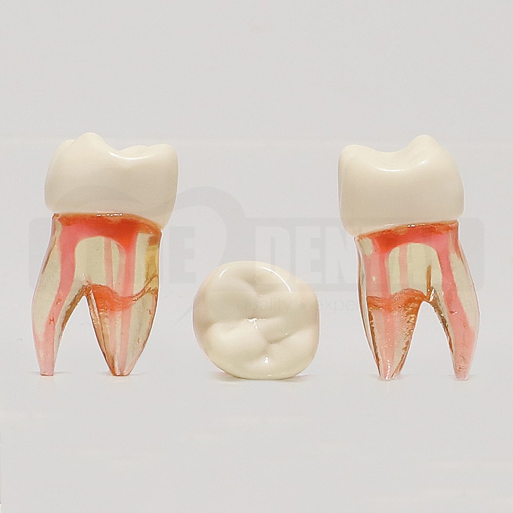 Natural Root Endo Tooth 16 MB2