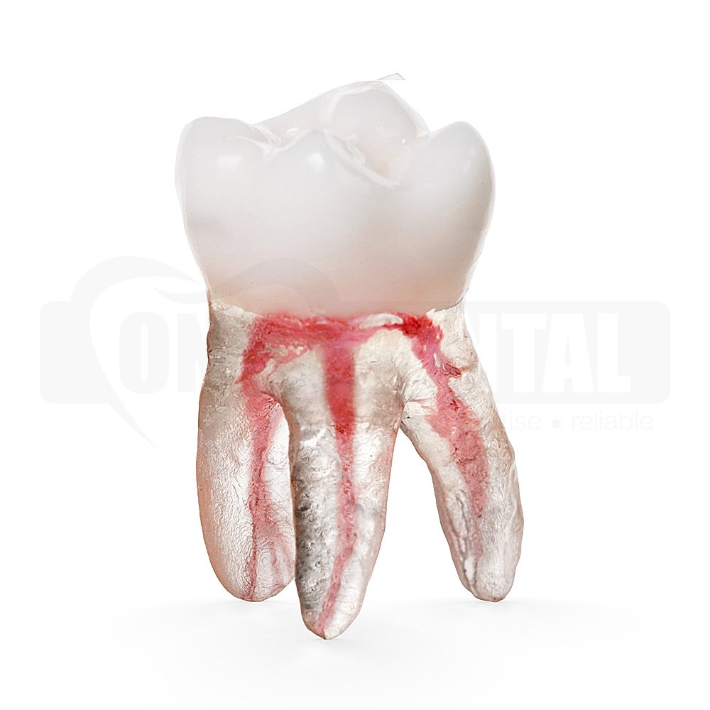 Natural Root X2 Endo Tooth 16 MB1 MB2 (Radiopaque)