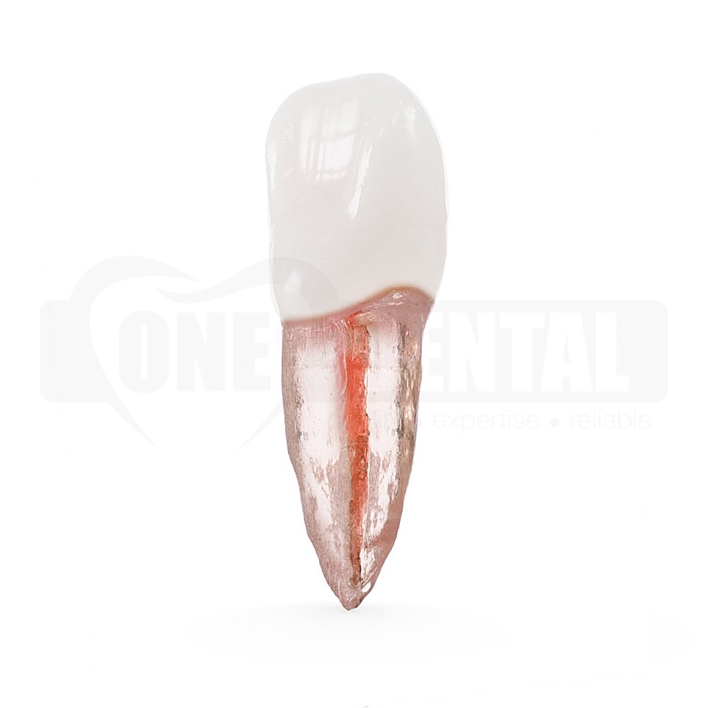 Natural Root X2 Endo Tooth 21 (Radiopaque)