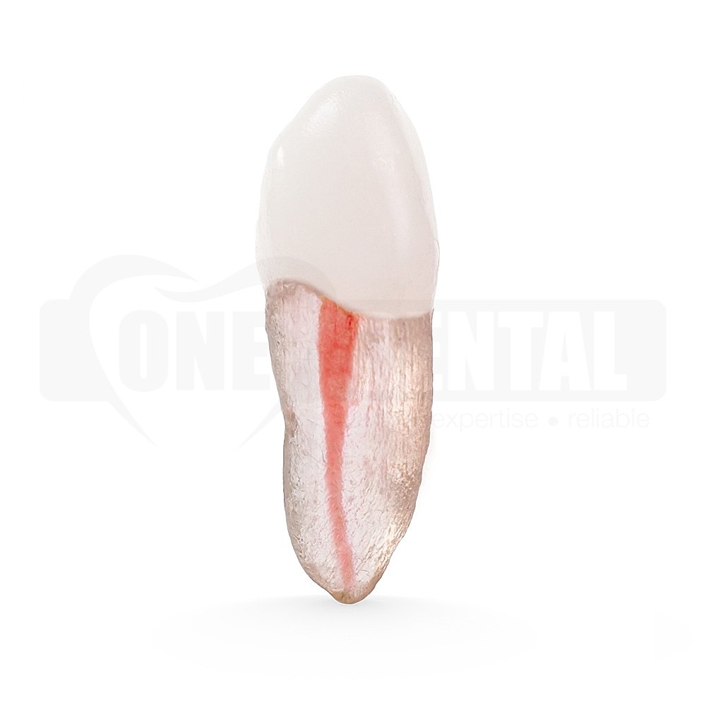 Natural Root X2 Endo Tooth 23 (Radiopaque)