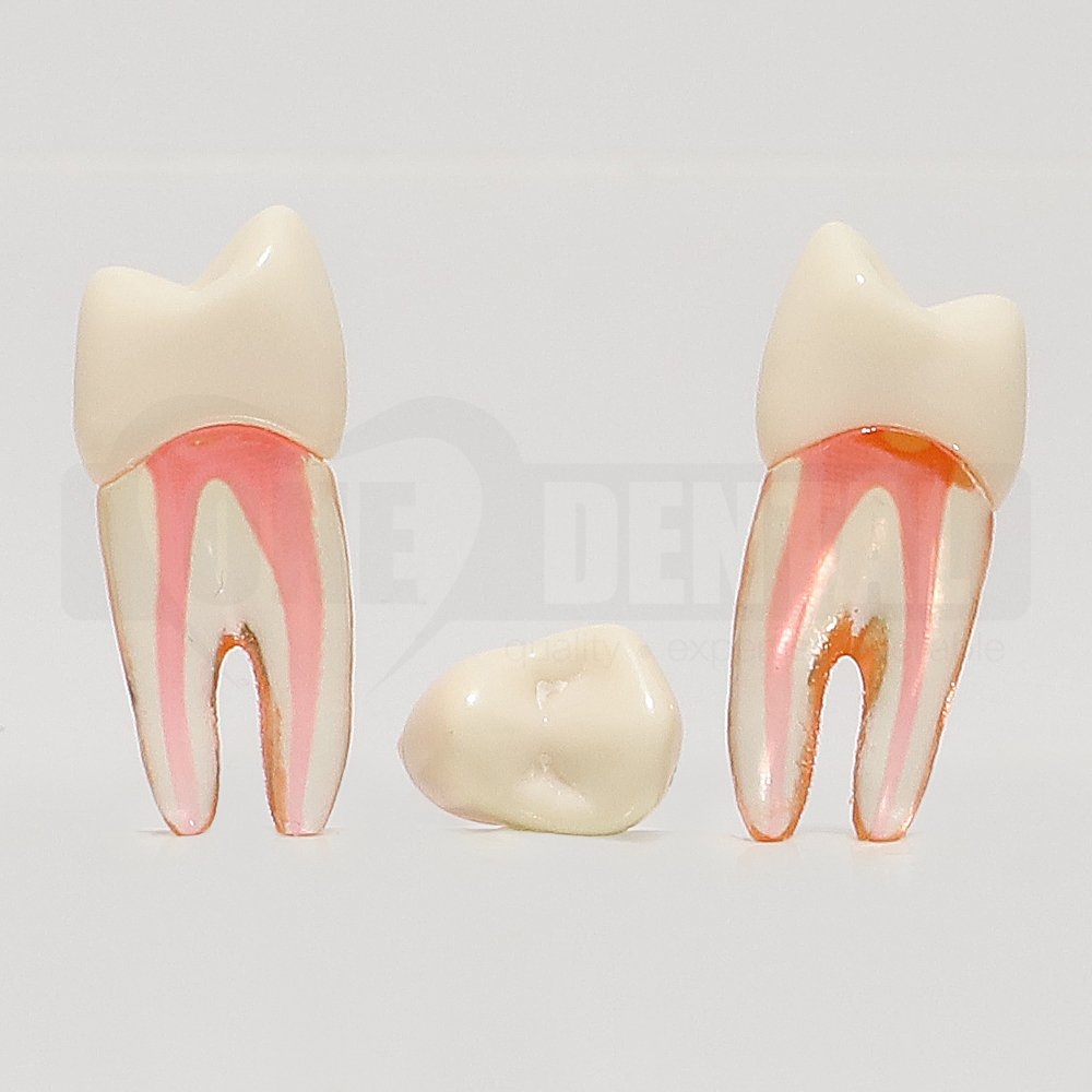 Natural Root Endo Tooth 24