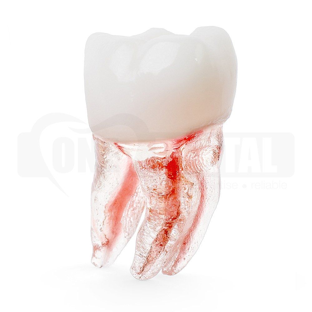 Natural Root X2 Endo Tooth 46 (Radiopaque)