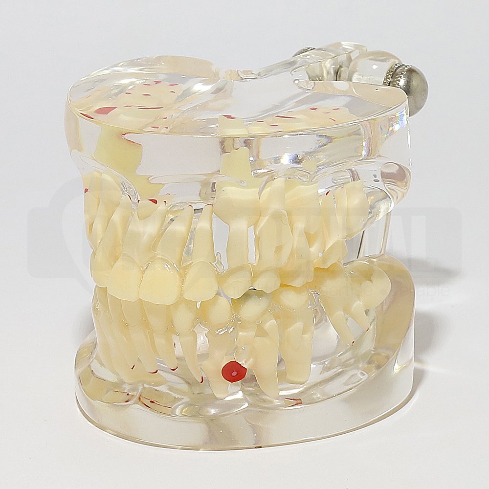 Solid Transparent Mixed Dentition Pathology Model