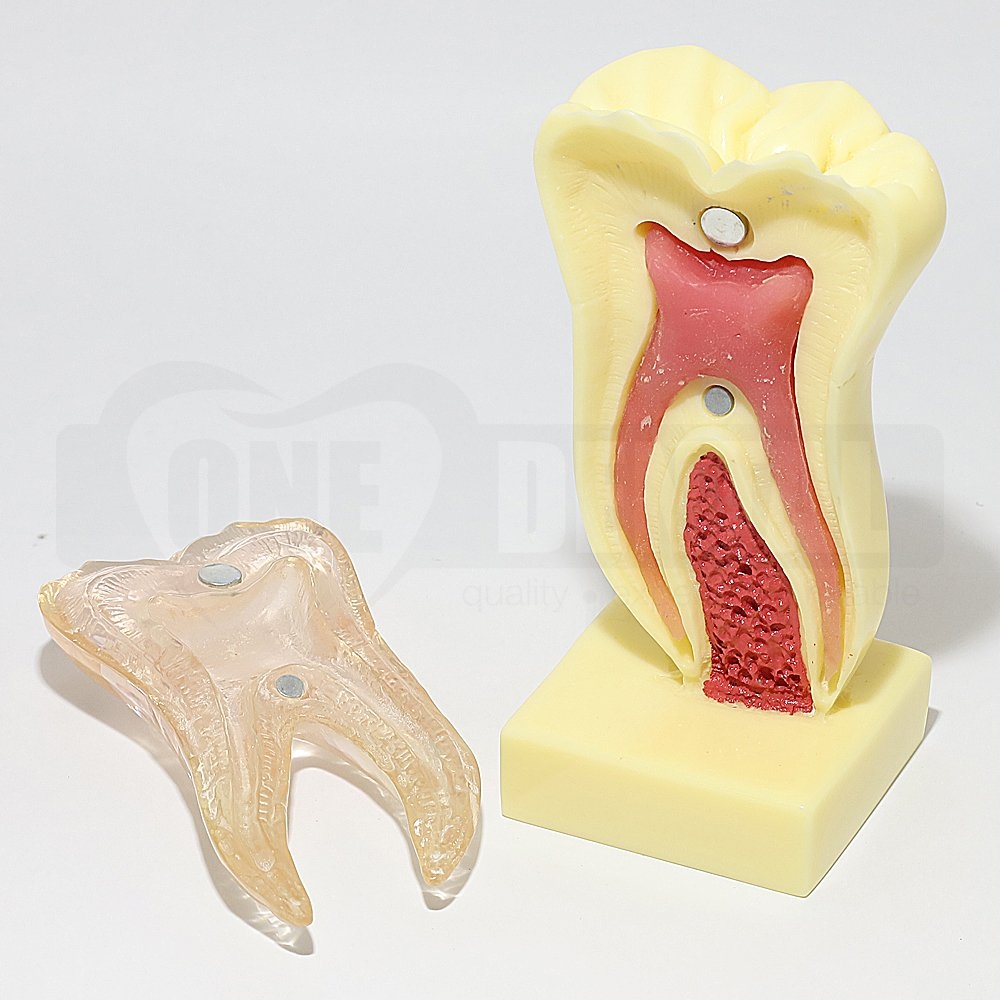 Adult XL Pulp Tooth