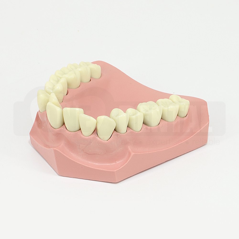 Ortho Model with crowded upper anteriors